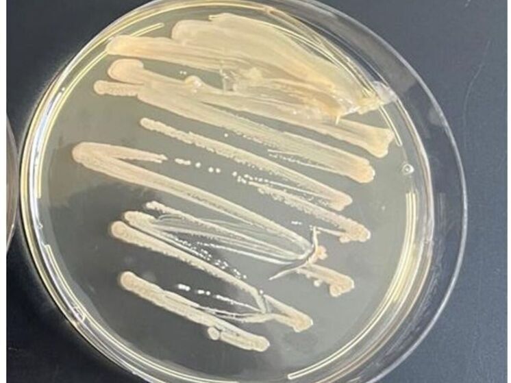 На основе тысячелетней бактерии из погребения изготовили молочнокислую закваску